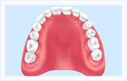義歯・入れ歯